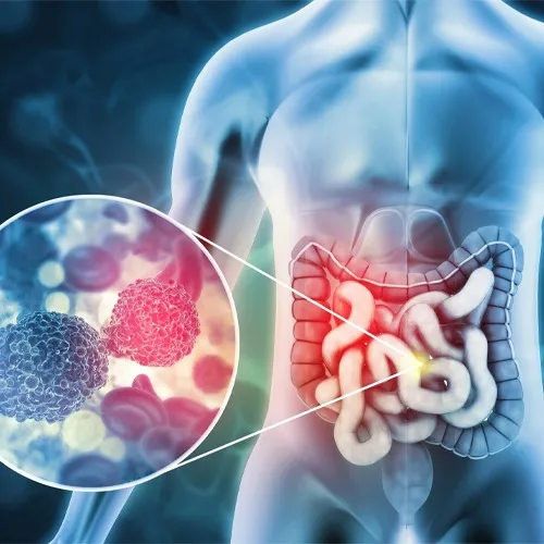 Best Surgical Oncologists